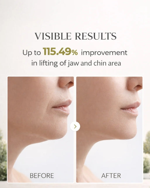 Cactox V-Lifting Mewing Band (4x Masks Per Pack)